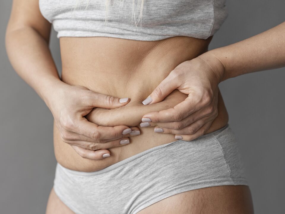 Abdomen de uma mulher com gordura localizada