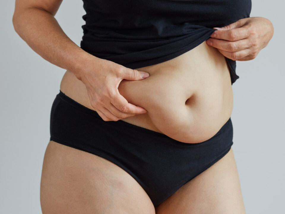 Moça mostrando um pedaço da barriga e apertando a gordura