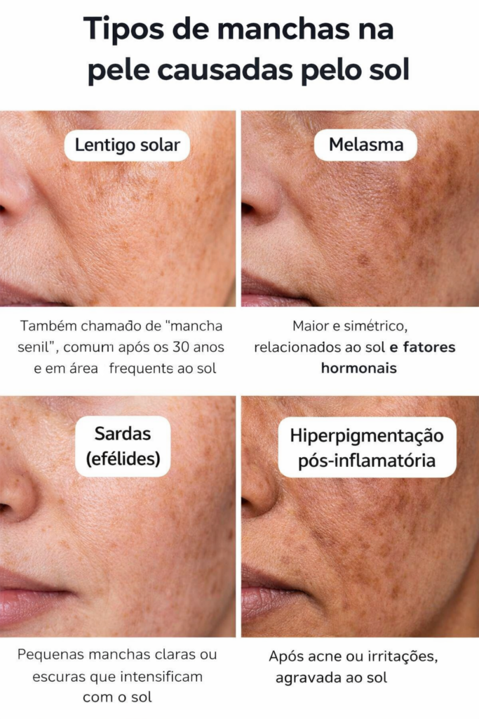 tipos de manchas na pele