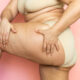 diferença entre lipedema e gordura localizada
