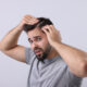 queda de cabelo masculina