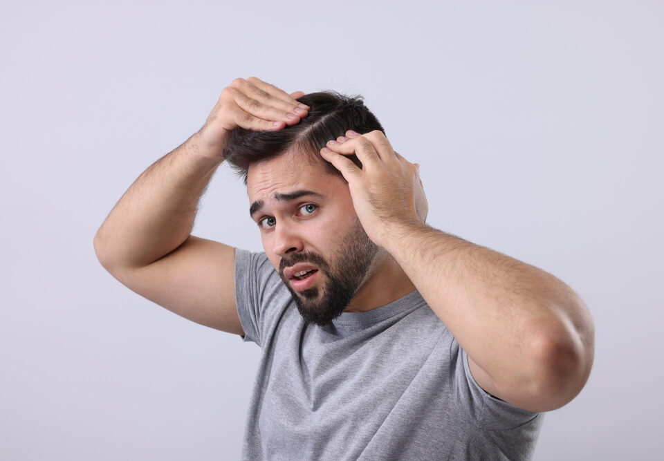 queda de cabelo masculina